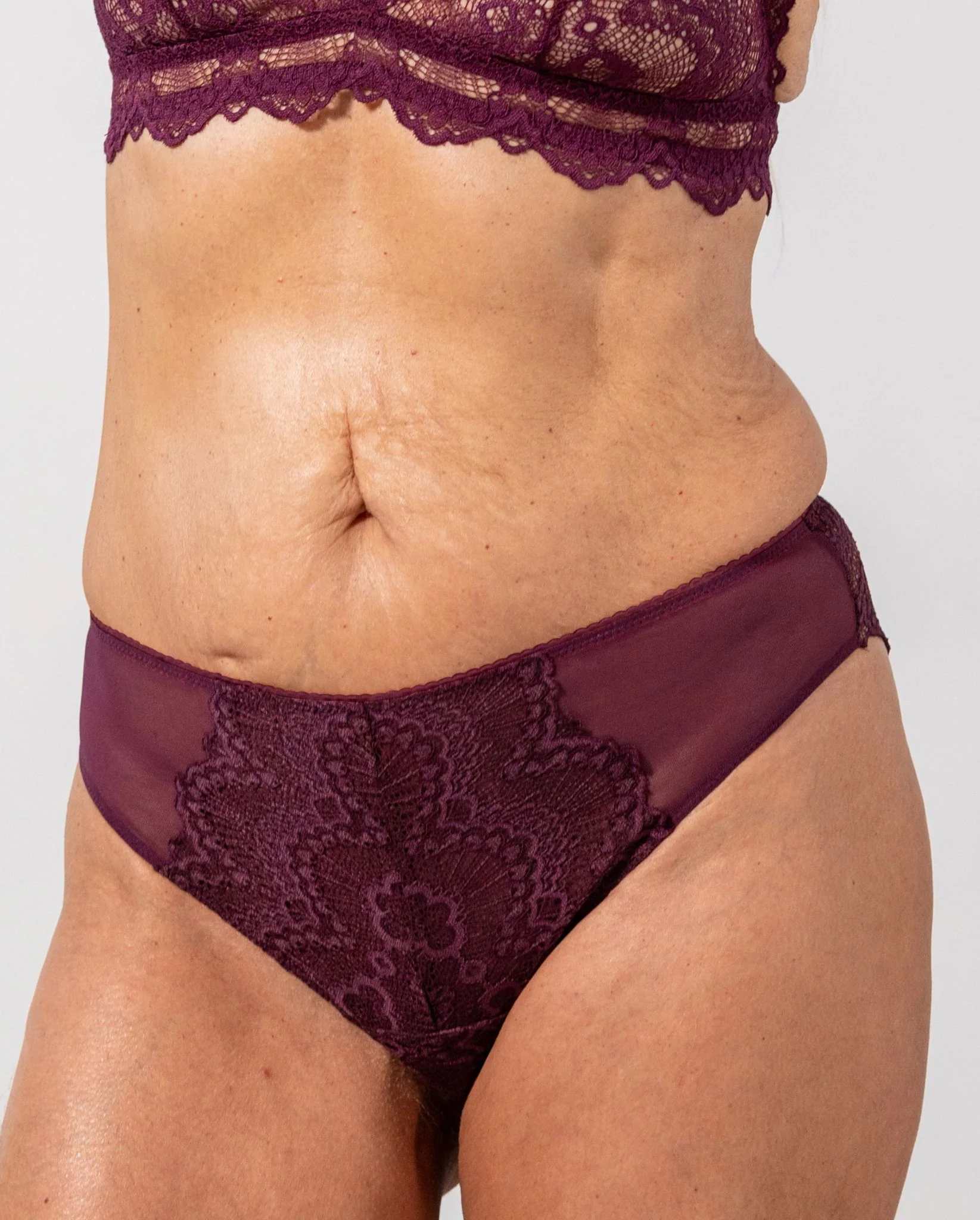 Lace Cheeky Cherry - Image 13
